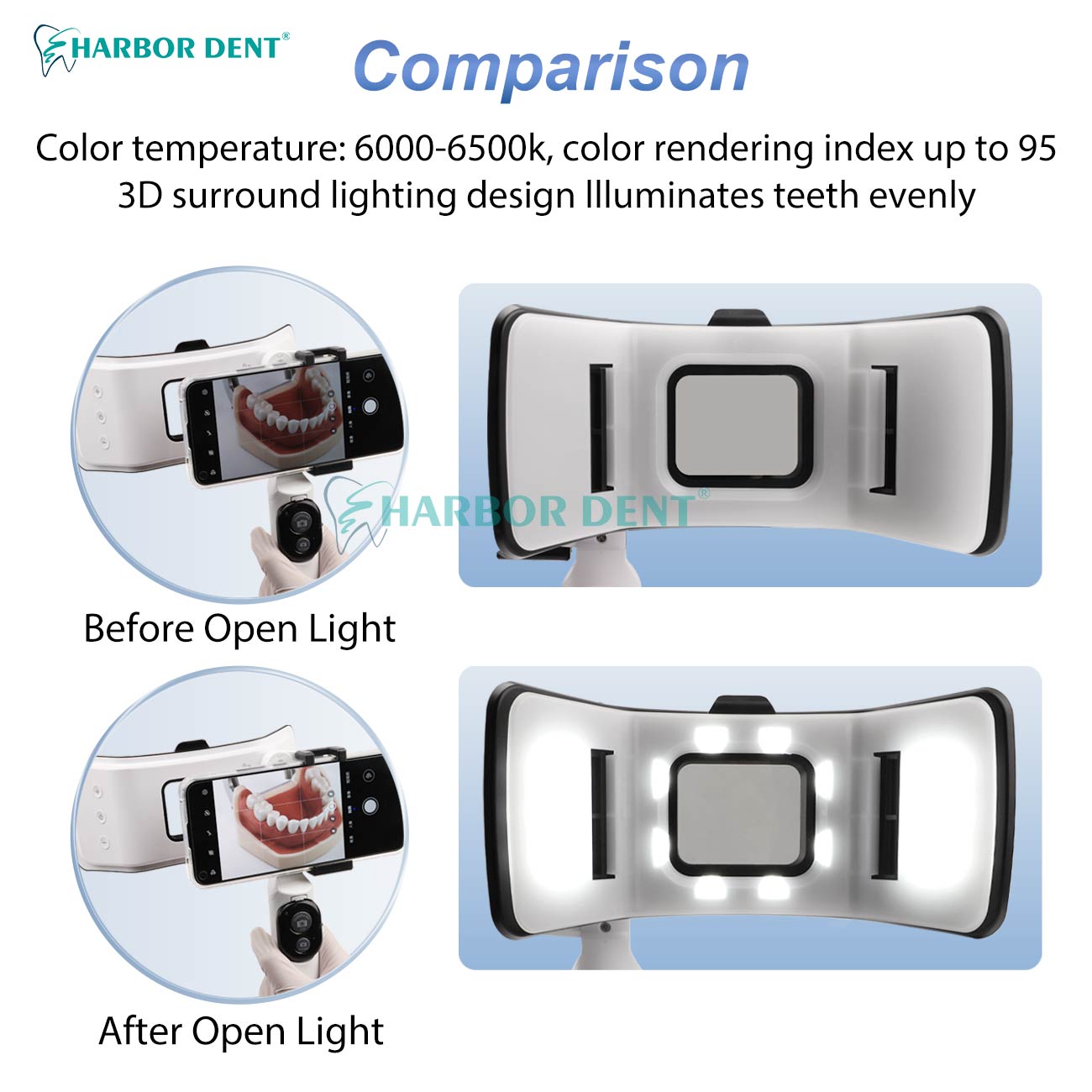 Good Price Dental Photography  - огляд і ціна Good Lighting In Photography